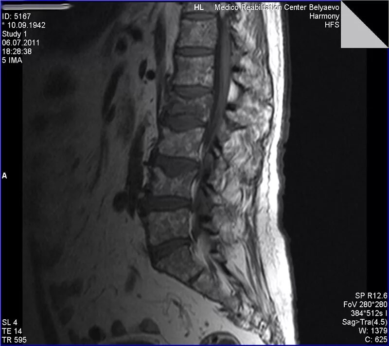 крестцовый отдел гимнастика. крестцовый отдел гимнастика. лечебная физкультура при поясничной грыже позвоночника. крестцовый отдел гимнастика. гимнастика для укрепления мышц спины при протрузиях.