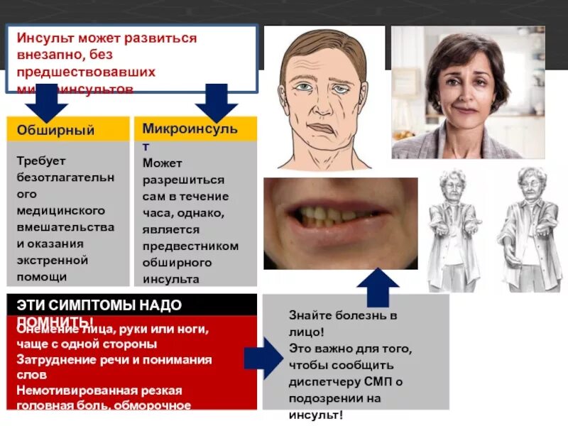 Инсульт можно выжить