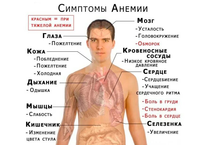 К анемии может привести недостаток. Симптомы малокровия у подростков. Дефицит железа симптомы.