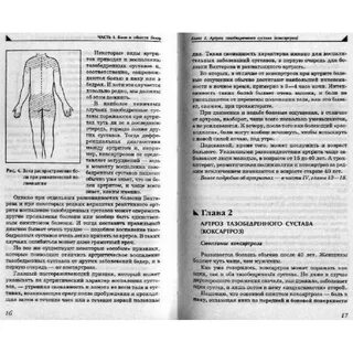Евдокименко лечение коксартроза тазобедренного сустава