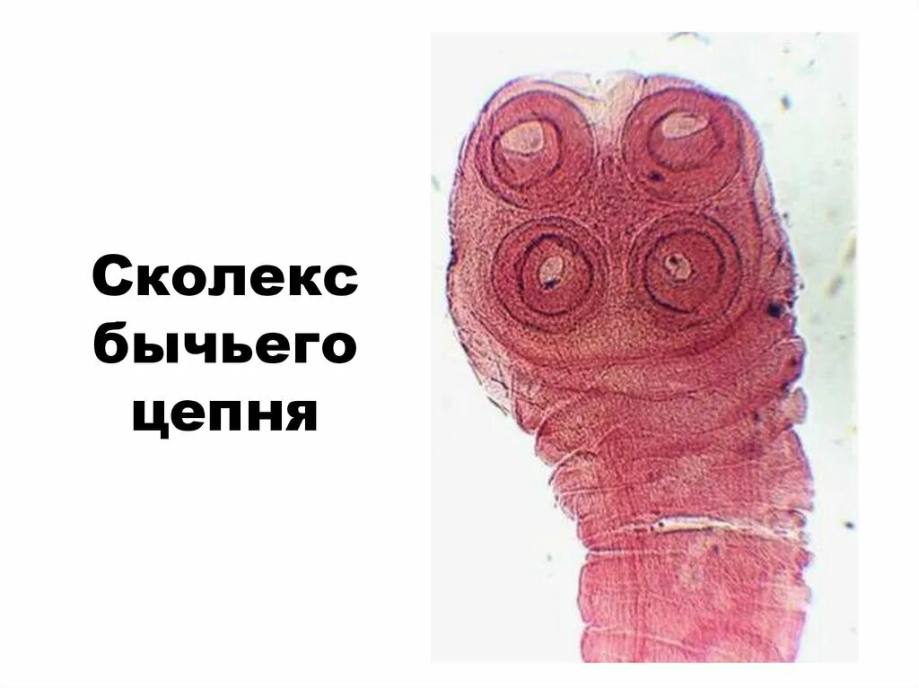 Установите правильную последовательность свиного солитера. Сколекс бычьего цепня препарат. сколекс свиного солитера.