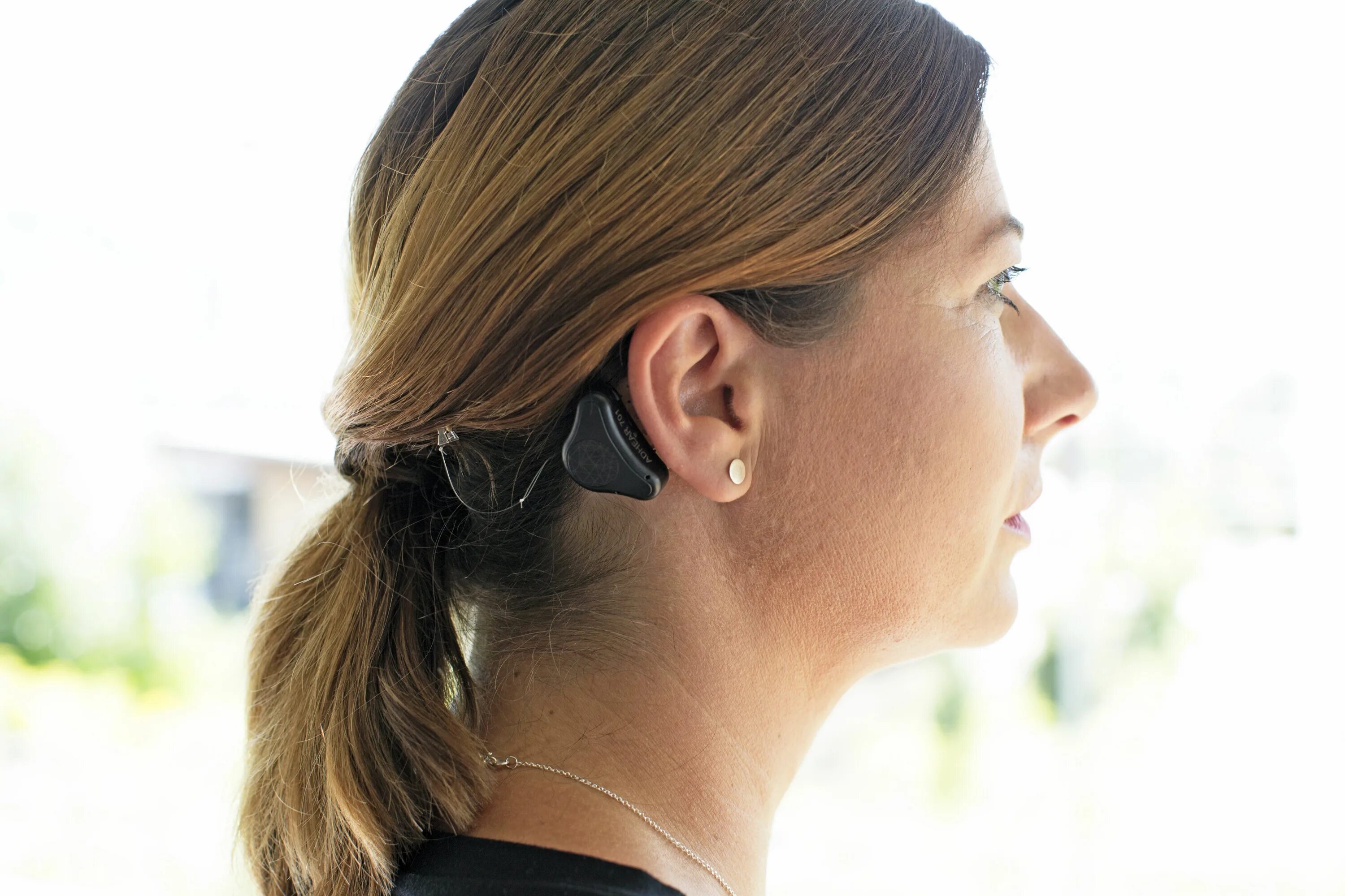 ADHEAR слуховой аппарат. Слуховой аппарат с костной проводимостью ADHEAR. Слуховой аппарат костной проводимости ponto. Девушка со слуховым аппаратом. Hear system