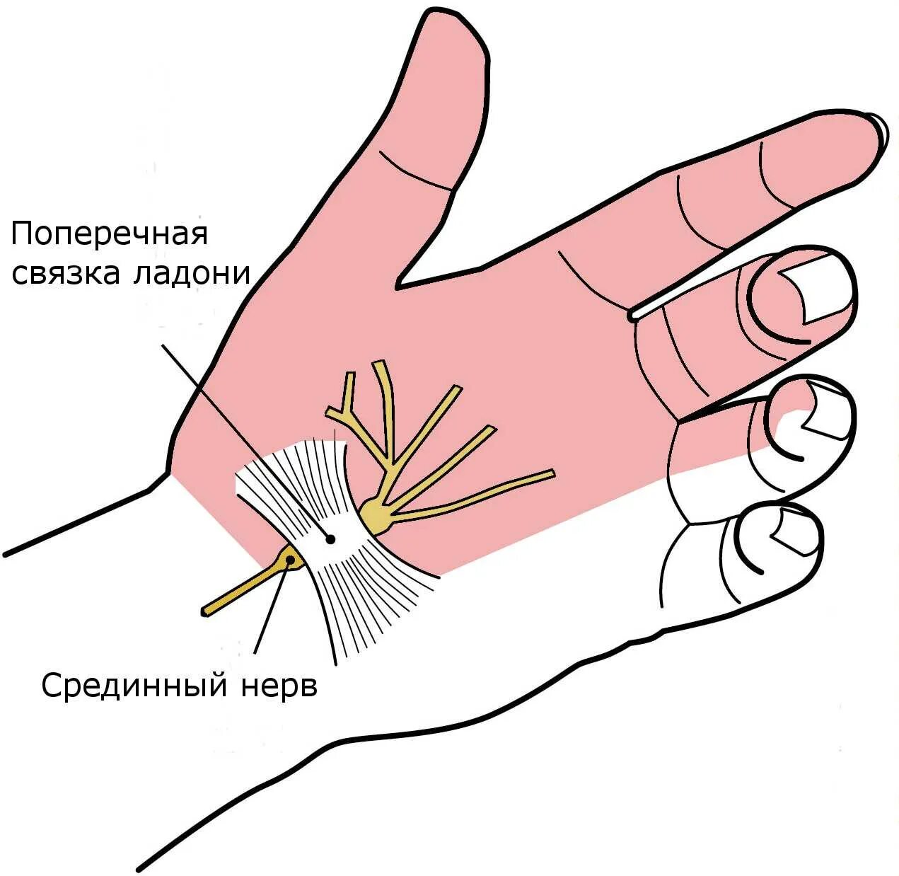 Карпальный (запястный) туннельный синдром. Туннельный синдром лучезапястного сустава. Туннельный синдром карпальный канал. Синдром лучезапястного канала (туннельный синдром). Нейропатия кисти