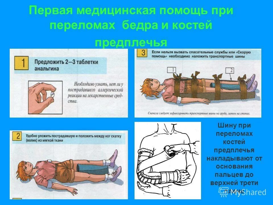 перелом бедра действия. оказание 1 помощи при переломе бедра. первая медицинская помощь при закрытом переломе бедренной кости. первая медицинская помощь при открытом переломе бедренной кости. оказание первой помощи при переломе бедра.