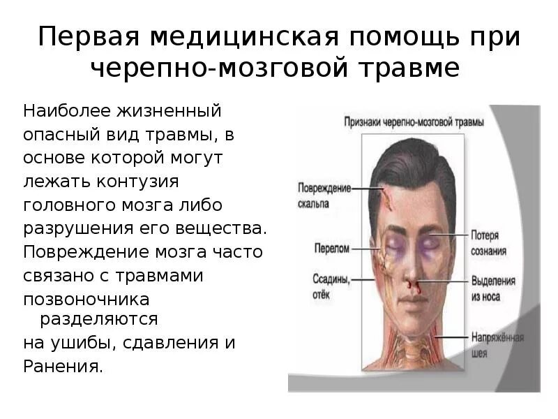 Зчмт сотрясение головного. ЧМТ повреждения костей черепа. Контузия при черепно мозговой травме. Закрытые черепно мозговые травмы.