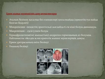 Ішімдік ішкен әйел есекке сіңіп кеткен