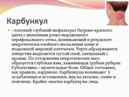 Часто встречающиеся болезни
