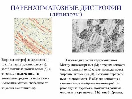 Причины паренхиматозной жировой дистрофии