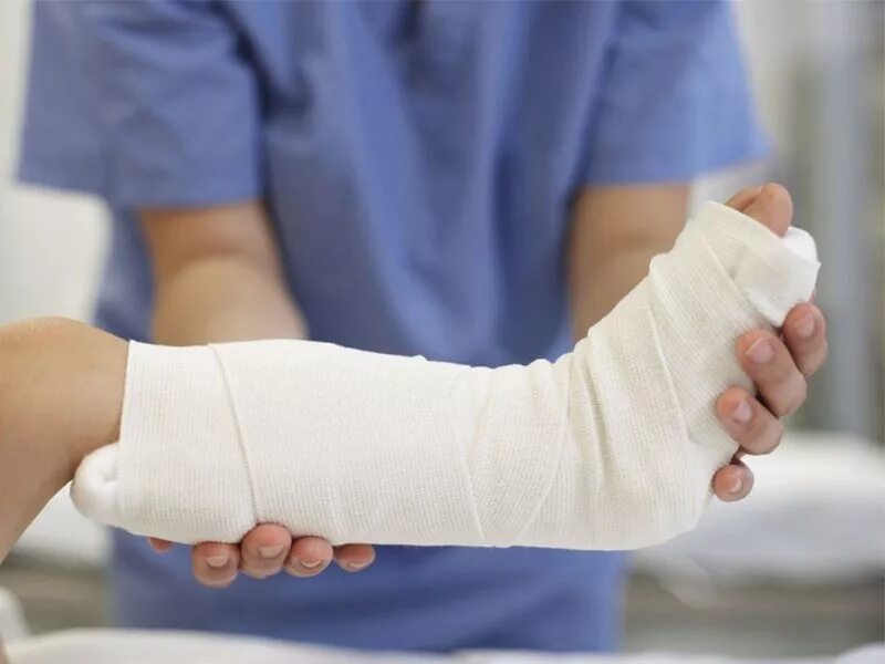 Открытый перелом со смещением костей. Виды переломов трубчатых костей по локализации. Классификация переломов костей конечностей. Виды переломов трубчатых костей по локализации. Переломы костей конечностей.