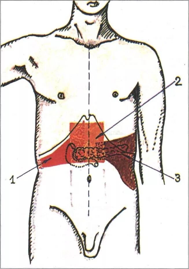 Эпигастрий находится у человека. Пальпация поджелудочной железе. Хронический панкреатит локализация боли. Зоны пальпации поджелудочной железы. Иррадиация боли поджелудочной железы.