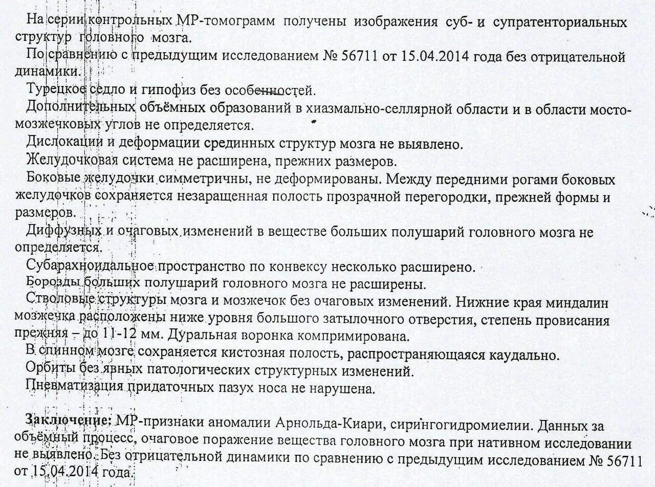 Аномалия киари степени. Мальформация Арнольда-Киари 1. Арнольда Киари аномалия степени. Типы мальформации Арнольда Киари. Диагноз аномалия Арнольда Киари.