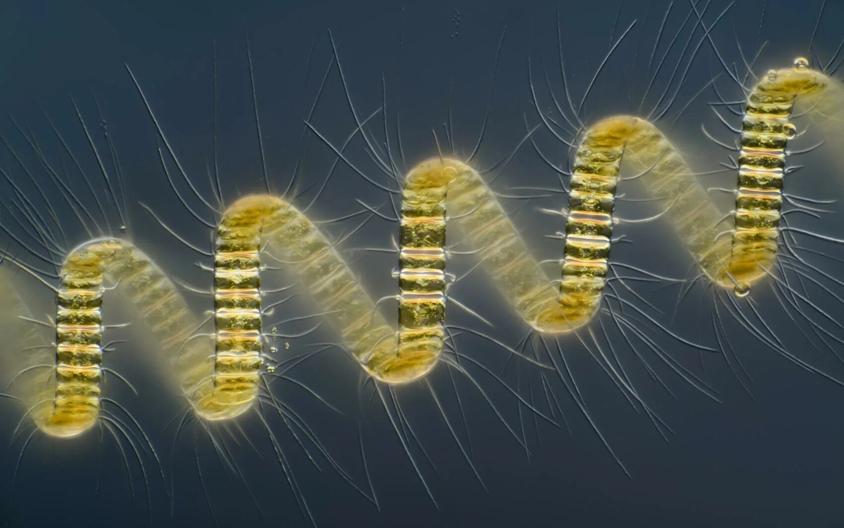 Фотография микро. Хетоцерос водоросль. Фитопланктон диатомовые водоросли. Chaetoceros gracilis. Обитатели микромира.