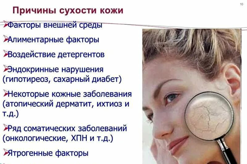 Почему очень сушит. Сухая кожа лица причины.