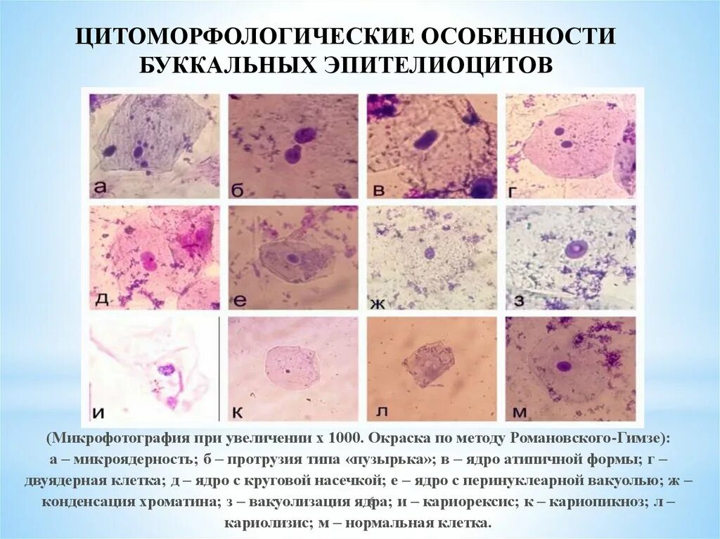 Кариопикноз это. Романовского Гимзе окраска бактерий. Метод окраски Романовского Гимзе. Окрашивание мазка по методу Романовского Гимзе. Окраска по Романовскому Гимза.