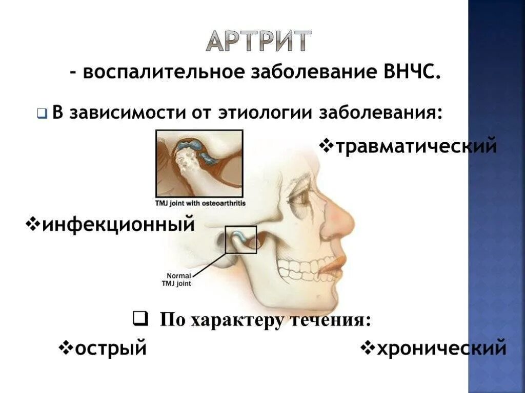 Деформирующий остеоартроз внчс рентген. Деформирующий остеоартроз внчс рентген. Артроз артрит внчс. Артроз артрит внчс. Артроз артрит внчс.