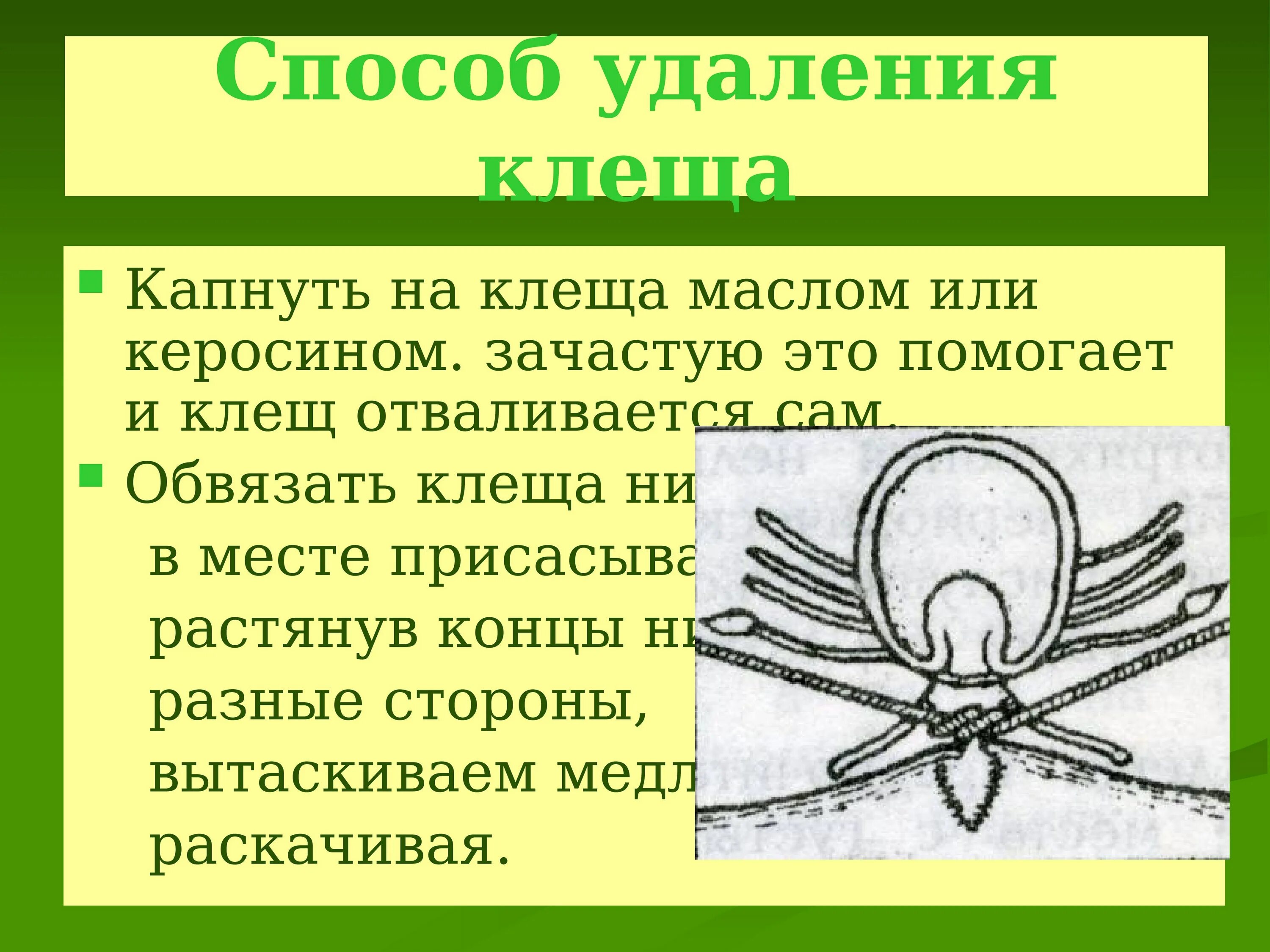 Каким образом нужно снимать присосавшегося клеща. Как вытащить клеща с помощью нитки. как ниткой достать клещей. как достать клеща с помощью нитки.