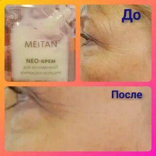 Нео крем отзывы