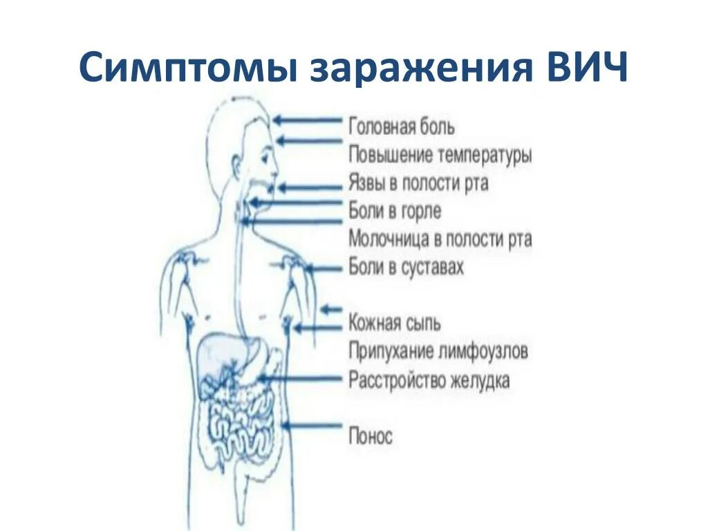 Признаки проявляющегося спида. Первые основные симптомы ВИЧ. Прищнакиви ВИЧ.