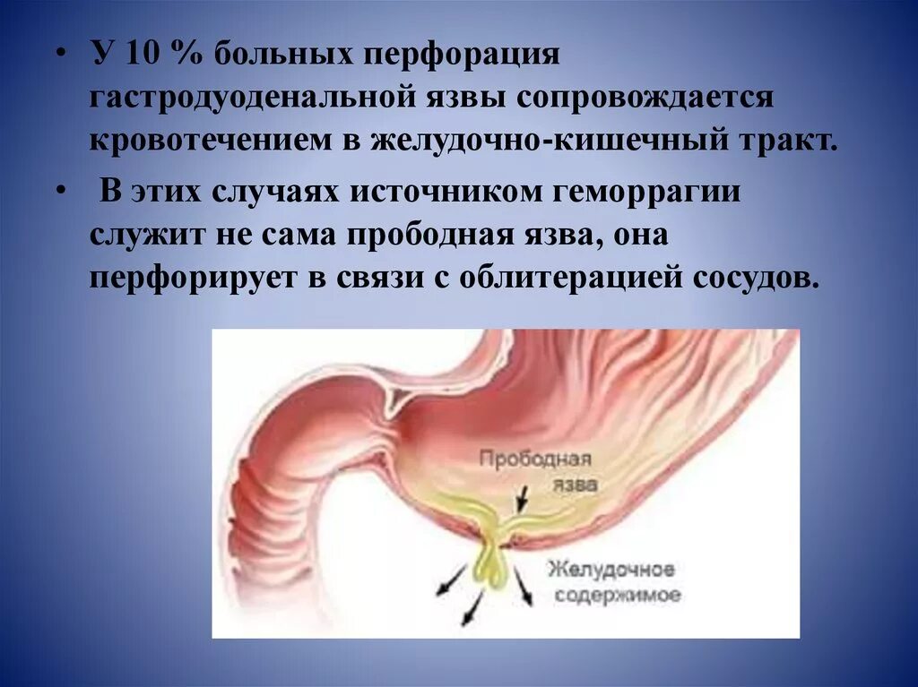 Перфоративная язва желудка клинические симптомы. Прободение язвы 12 перстной кишки. Прободение язвы желудка. Перфоративная язва двенадцатиперстной кишки.