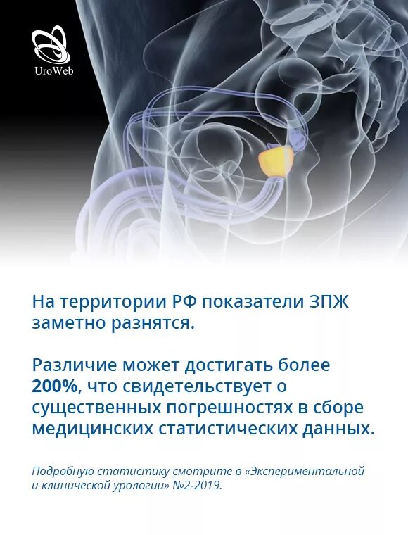 Инфекция простаты. Уровэб. Женской предстательной железе.