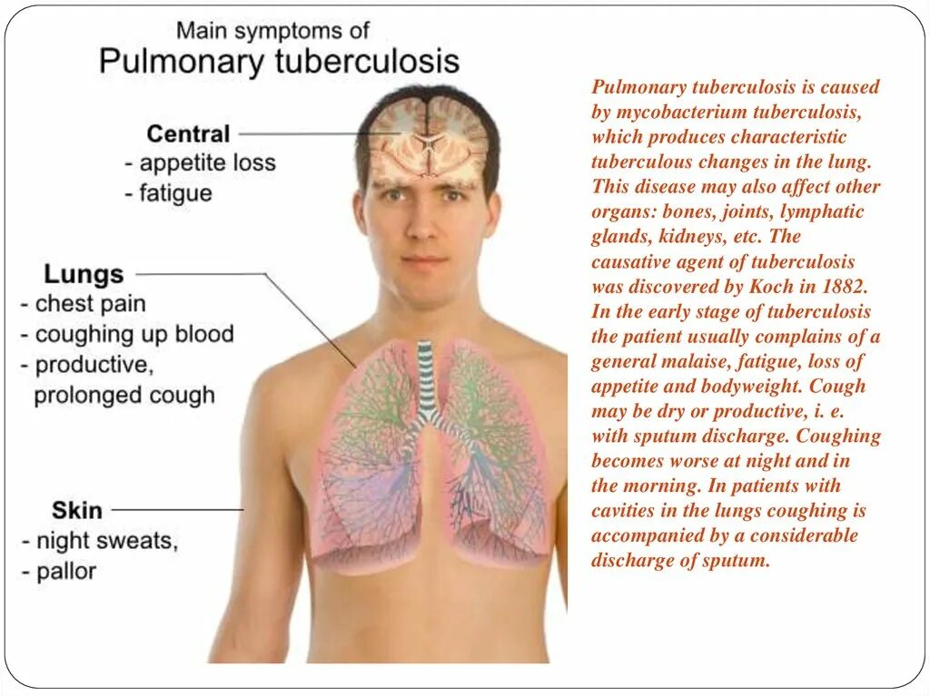 Основные проявления туберкулеза. Признаки проявления туберкулеза. Основные симптомы туберкулеза.