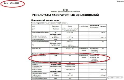 Как испортить мочу анализ