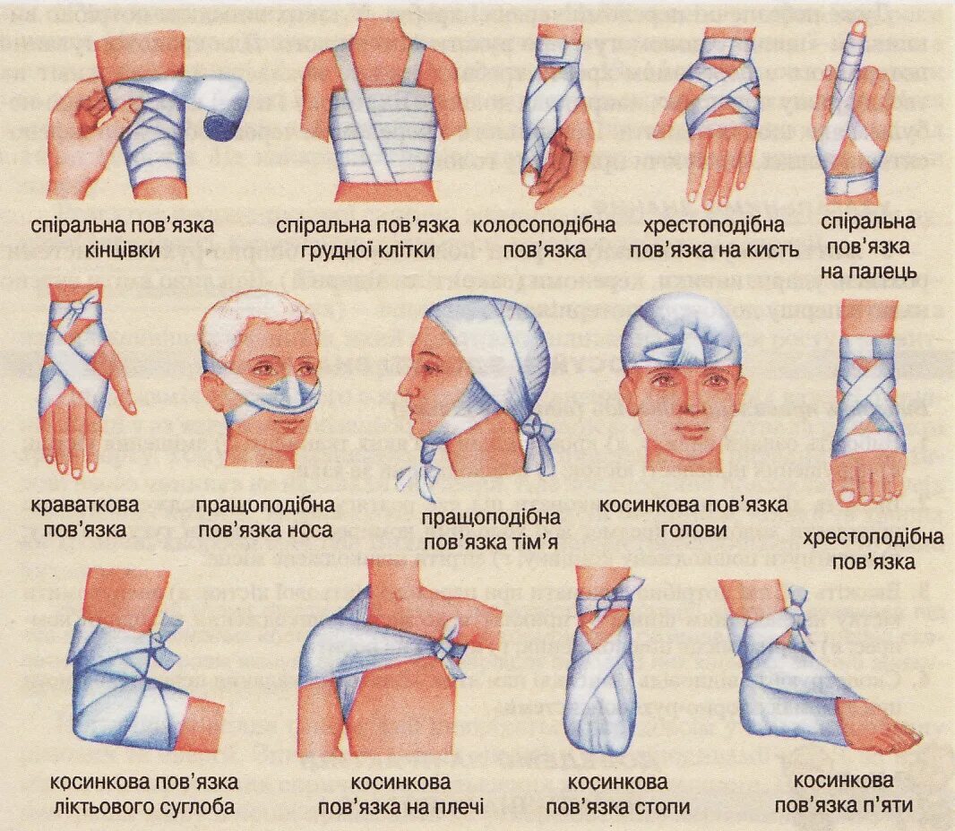 Основные типы повязок. Названия повязок. Виды повязок и название. Типы наложения повязок. Наименование повязок с картинками.