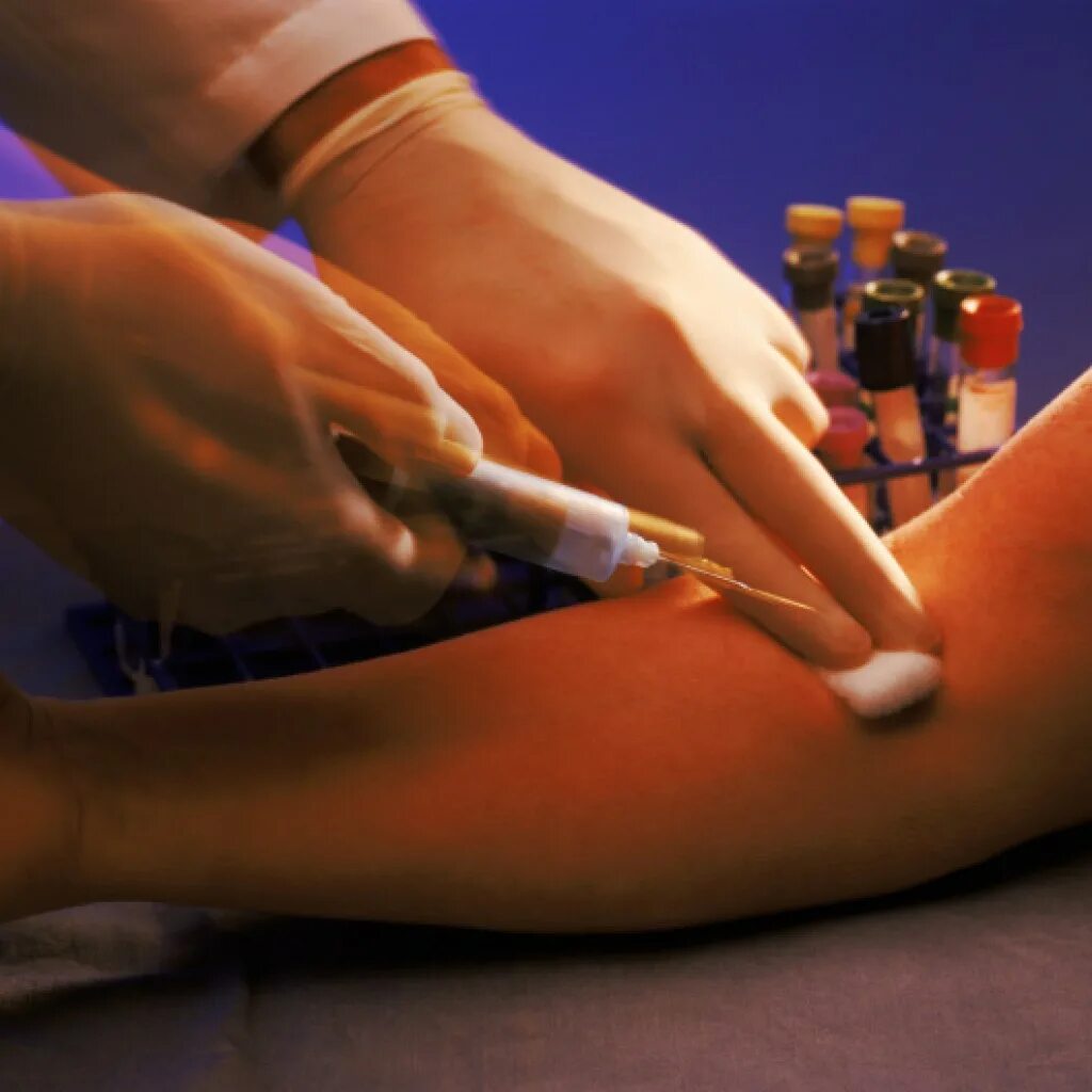 Горячий укол в ягодицу. Горячие уколы внутривенно. Горячий укол. Горячий укол. Кальция глюконат ампулы.