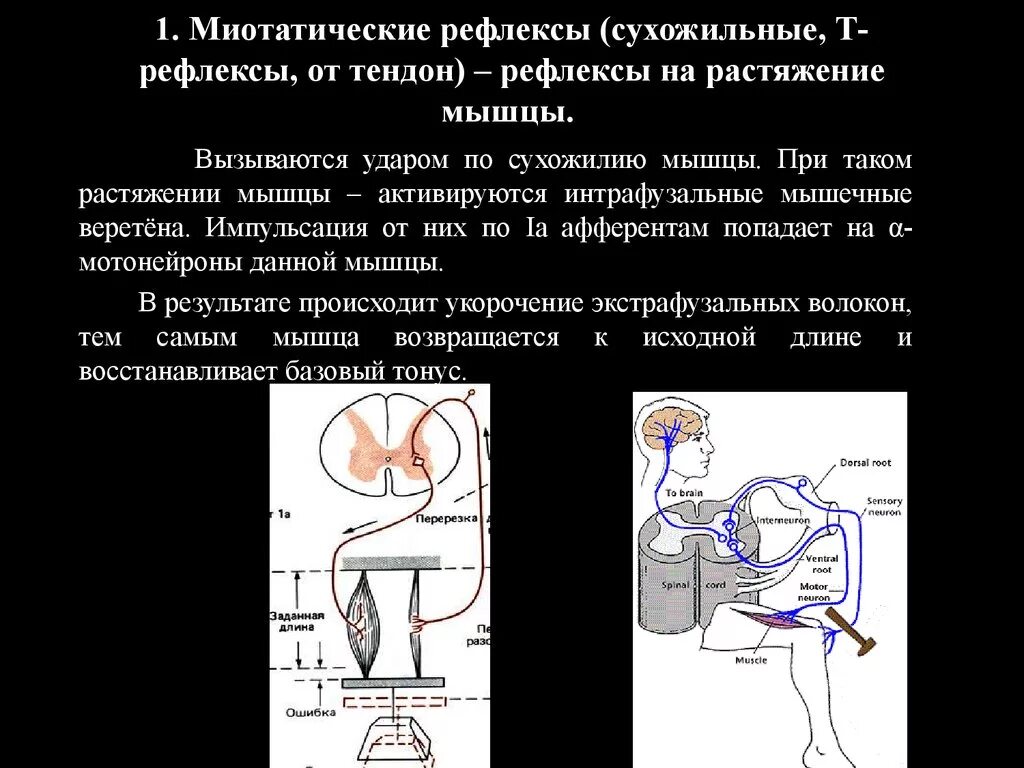 Рефлексы мышц. Миотатический рефлекс растяжения мышцы. Рефлекторная дуга миотатического и сухожильного рефлексов. Обратный Миотатический рефлекс физиология. Миотатический рефлекс дуга.
