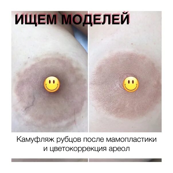 Красивые ореолы