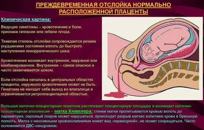 Секс Во Время Беременности Отзывы