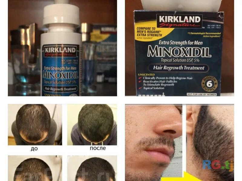 Миноксидил 5 для волос. Миноксидил 3 в 1. Minoxidil 5% Original. Средства для бороды 5% миноксидил. Средство для роста волос бороды