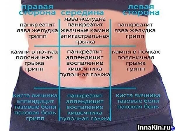 Области живота. Боли в животе. Боли в области живота. Схема боли в животе.