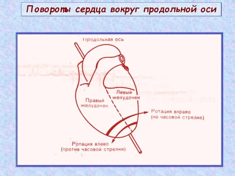 Повороты сердца вокруг продольной. Определение поворотов сердца вокруг продольной оси. Повороты сердца на ЭКГ вокруг продольной оси. Поворот сердца вокруг продольной оси по часовой стрелке. Поворот правым желудочком вперед