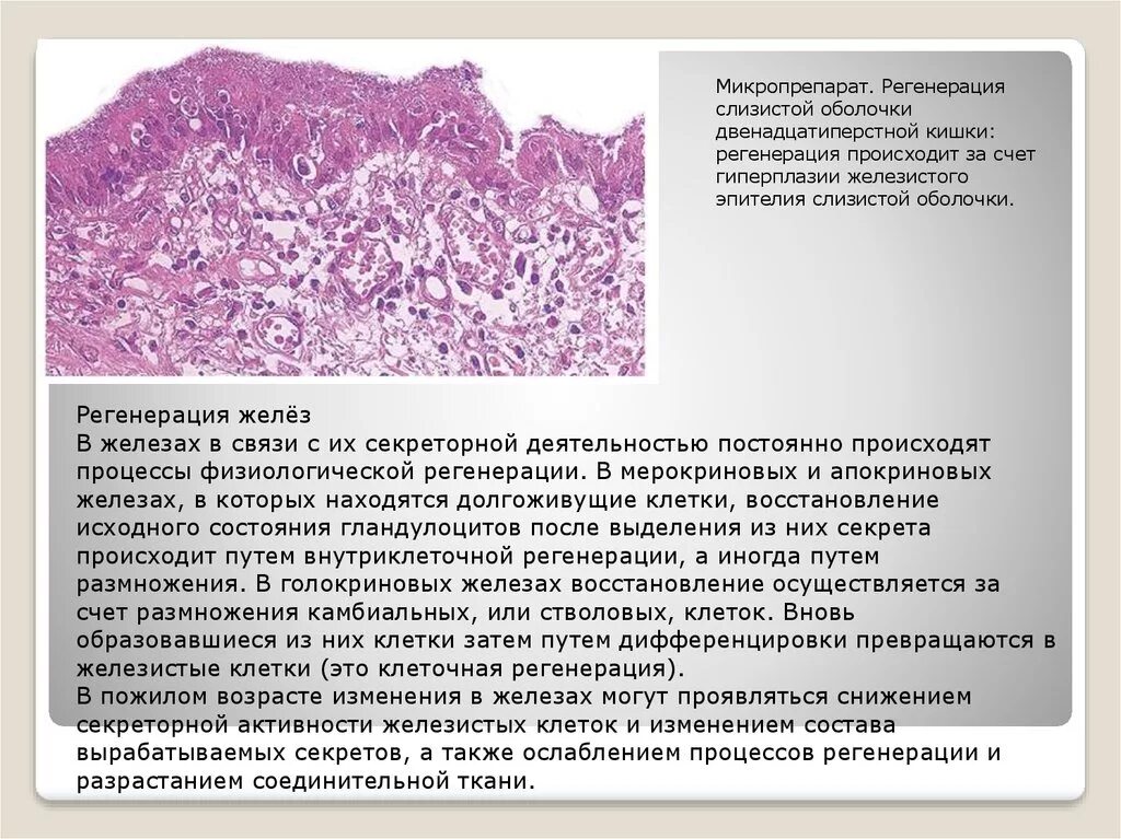 Регенерации слизистой оболочки. Регенерация эпителия слизистой оболочки. Железистый эпителий физиологическая регенерация. Железистая гиперплазия гистология. Железы двенадцатиперстной кишки гистология.