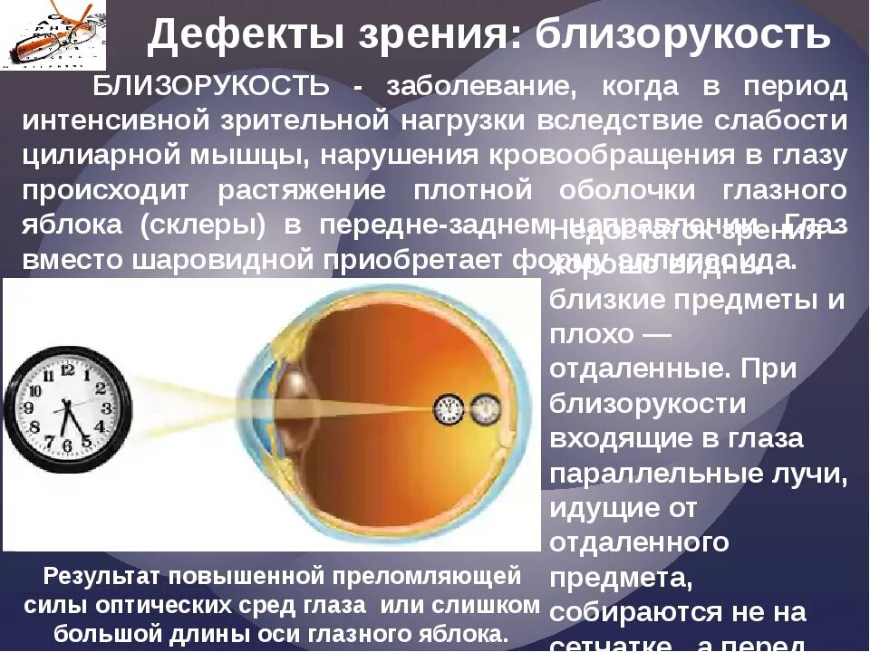 Дефекты зрения ответы. Нарушение зрения близорукость. Дефекты зрения близорукость. Болезнь глаз близорукость. Приобретенные дефекты зрения.