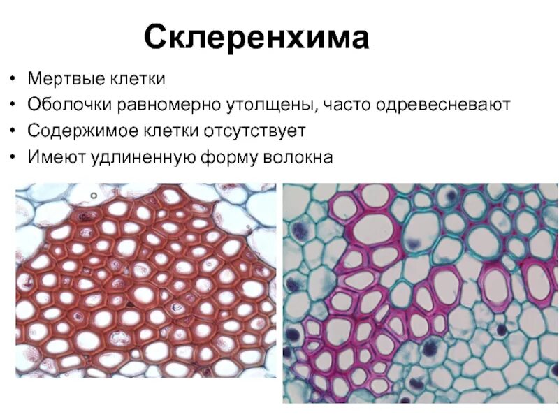 Имеет удлиненную форму в. Механическая ткань растений колленхима. Механическая ткань колленхима и склеренхима. Механическая ткань растений колленхима и склеренхима. Механические ткани колленхима склеренхима склереиды.