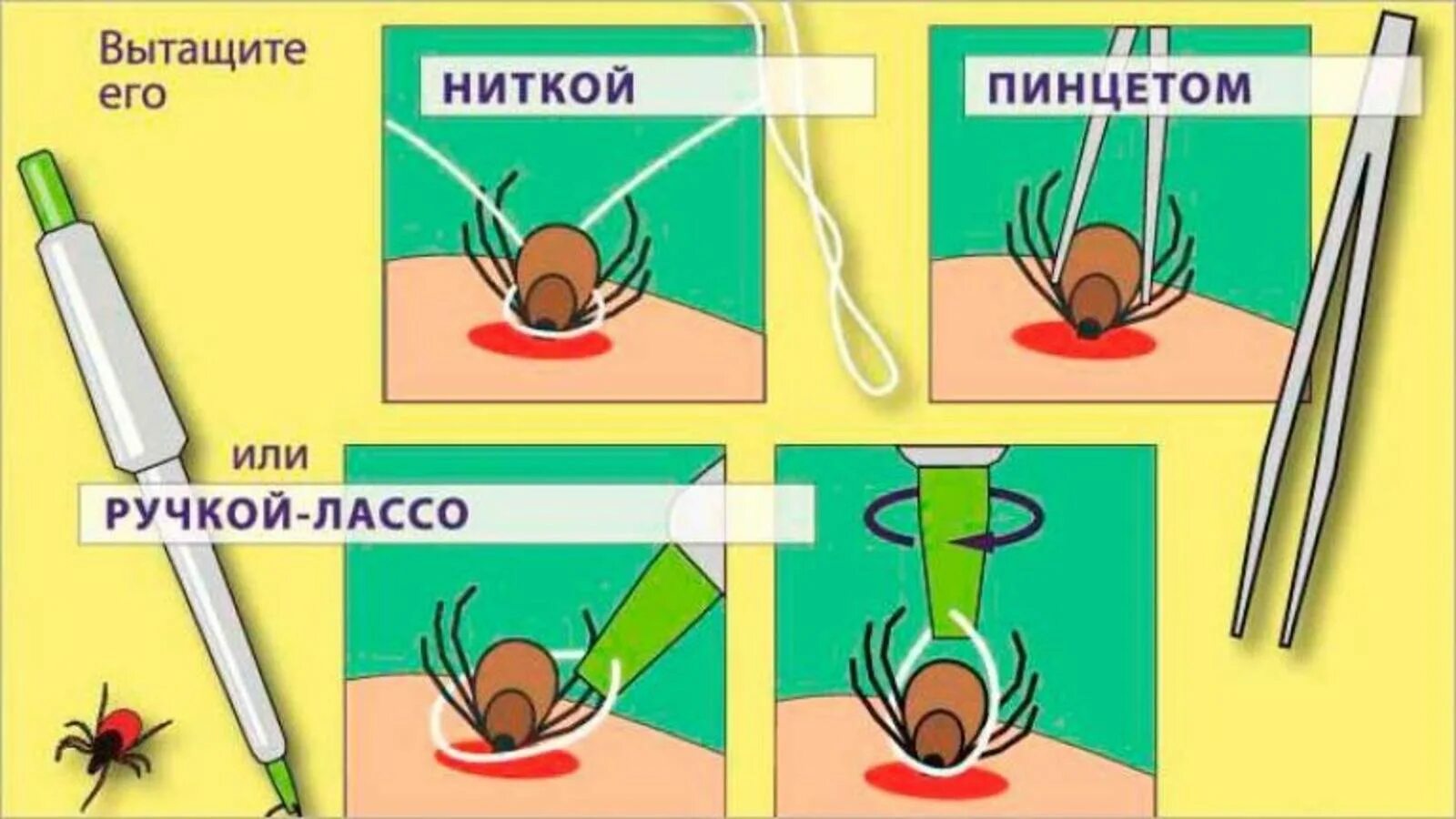 Алгоритм при укусе клеща. Первая помощь при укусе клеща. оказание доврачебной помощи при укусе клеща. первая помрщь прит укусеклеща. первавая помощь при укусе клеща.