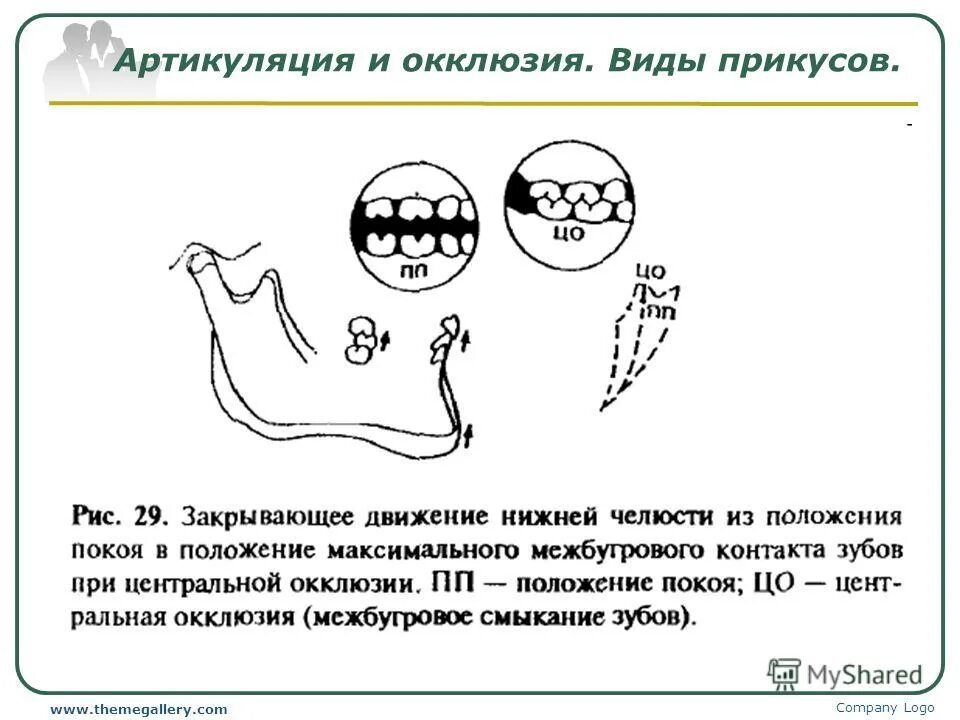 Артикуляция и окклюзия. Артикуляция и окклюзия виды. Артикуляция окклюзия прикус. Виды артикуляции в стоматологии. Артикуляция зубов