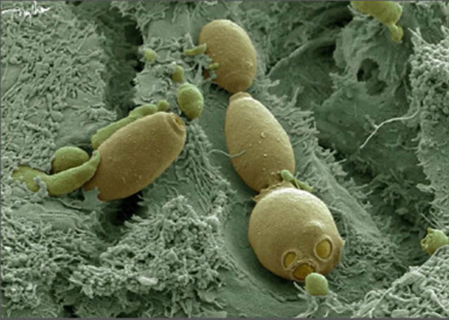 Дрожжевые грибы в кишечнике. Saccharomyces boulardii штамм. дрожжи бактерии сахаромицеты. дрожжевые грибки saccharomyces boulardii.. дрожжи сахаромицеты буларди.