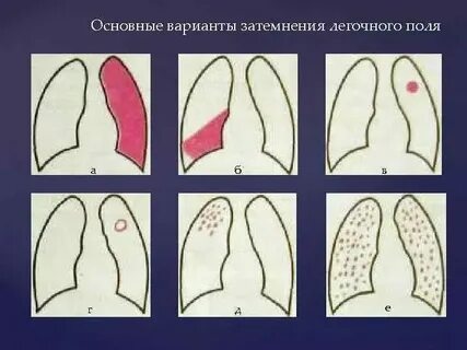 Стойкое тотальное нарушение