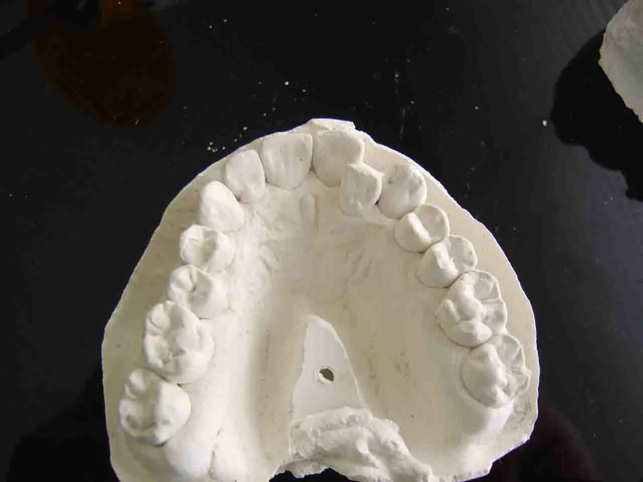 2 схема. 23 зуб. Зубы в стоматологии у взрослых. Нумерация зуб верхней челюсти. Зуб 1.