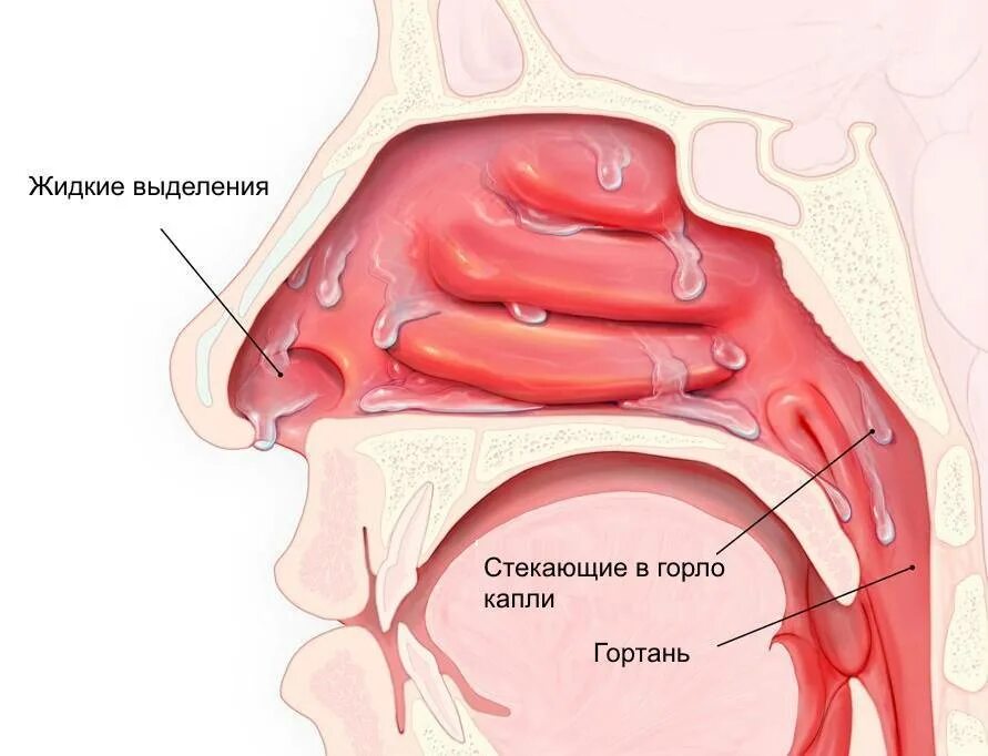 Капли для восстановления обоняния. Капли для регенерации слизистой носа. Можно ли каплями сжечь слизистую. Капли перекись водорода в нос. Антисептик для обработки гнойных ран.