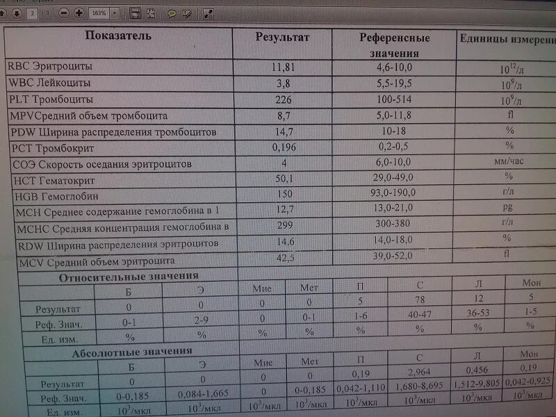 Индекс тромбоциты повышены. Ширина распределения тромбоцитов PDW норма. Ширина распределения тромбоцитов (PDW-SD) норма. PDW В анализе крови норма для женщин. Распределение тромбоцитов по объему, PDW.