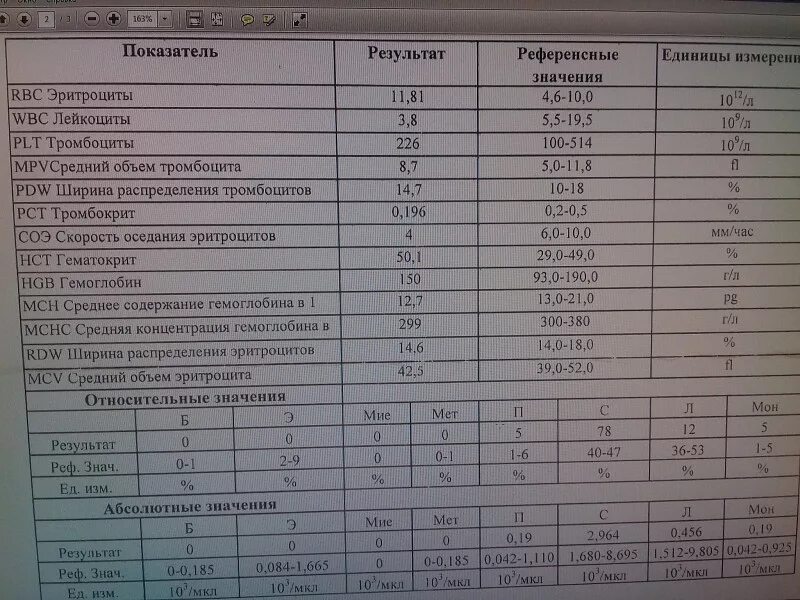 Pct повышен. Ширина распределения тромбоцитов PDW норма. Ширина распределения тромбоцитов (PDW-SD) норма. PDW В анализе крови норма для женщин. Распределение тромбоцитов по объему, PDW.