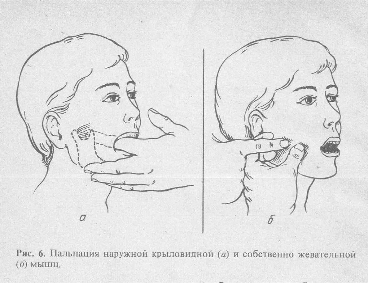 Больно открывать рот. Бимануальная пальпация жевательной мышцы. Пальпация жевательных мышц. Пальпация медиальной крыловидной мышцы. Пальпация нижней челюсти.