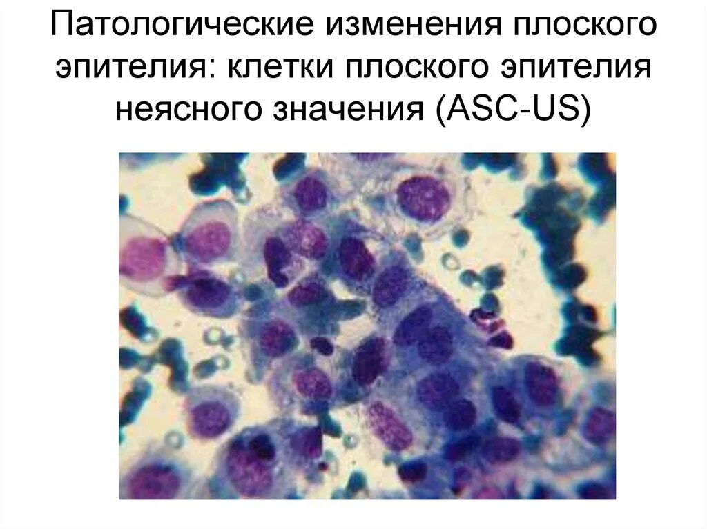 Реактивные изменения в цитологическом