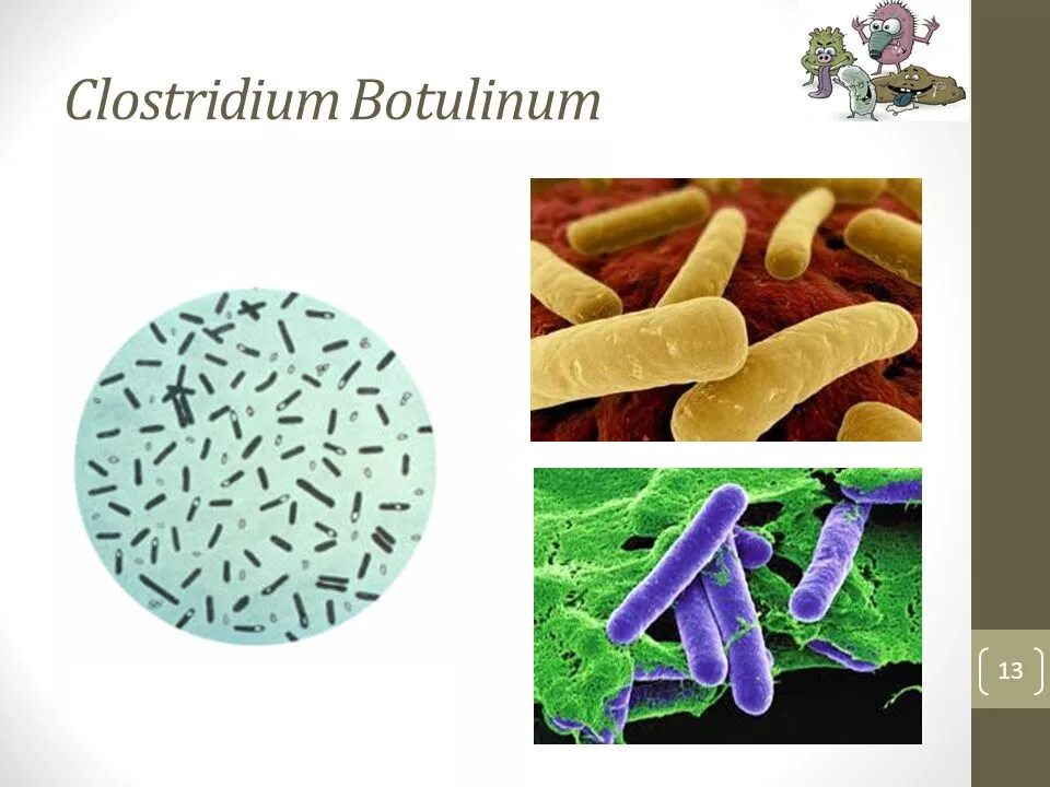 Клостридии ботулизма ( Clostridium botulinum ) ботулизм. Clostridium botulinum возбудитель ботулизма. Клостридии botulinum ботулизм.
