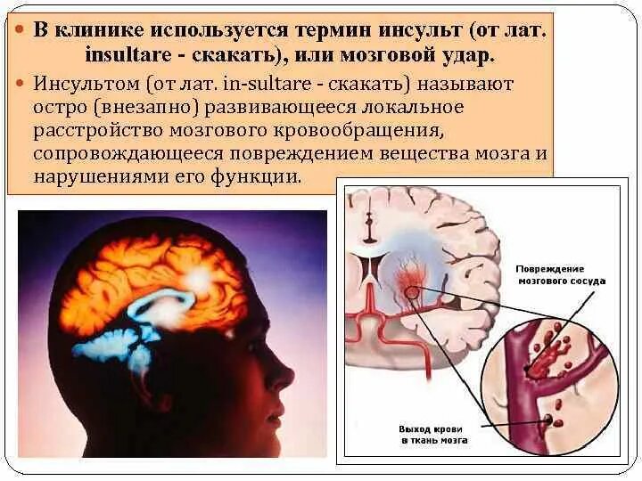 Удар инсульт. Ударил инсульт.