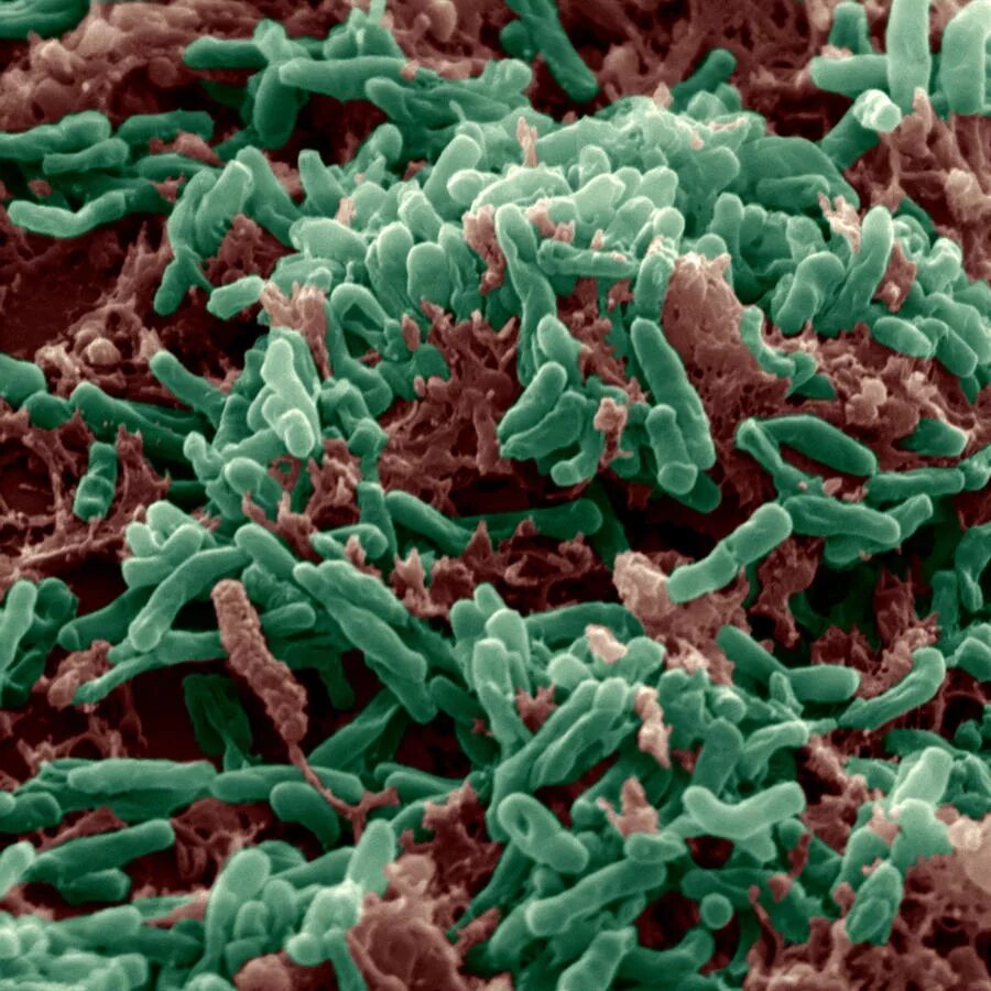 Бактерия Mycobacterium tuberculosis. Палочка Коха Mycobacterium tuberculosis. Туберкулез палочка Коха под микроскопом.